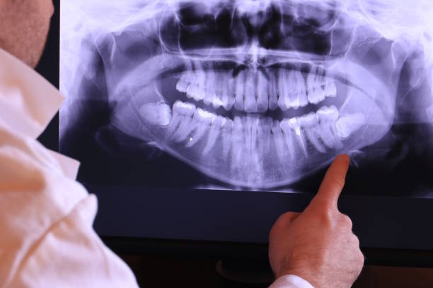 Best Emergency Tooth Extraction in Maiden, NC