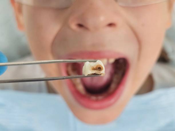 Best Same-Day Emergency Dentist in Maiden, NC