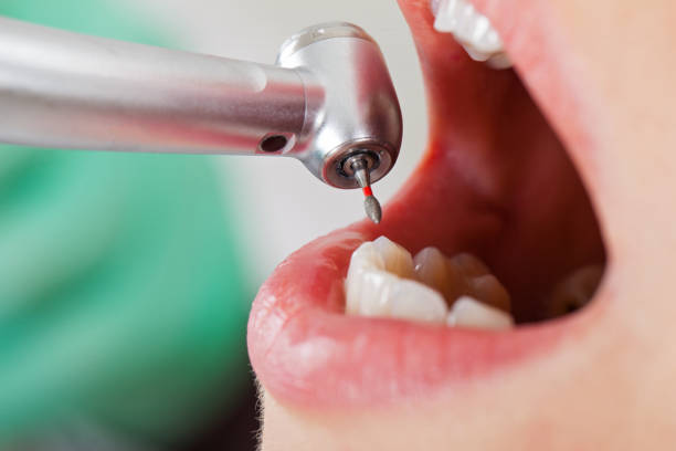 Best Pediatric Emergency Dentist in Maiden, NC